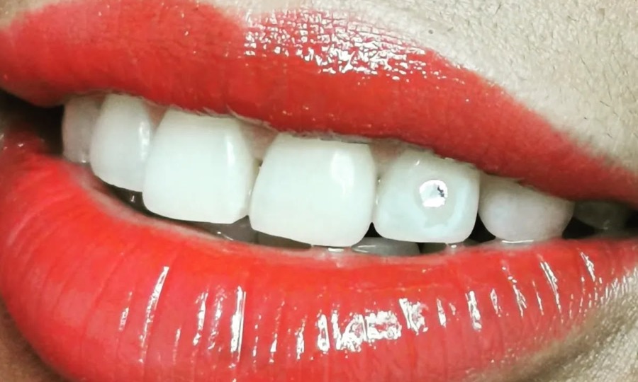 Sourire aux lèvres rouges avec un bijou dentaire Swarovski